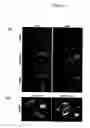 Fig. 08 - Cell-based detection of APF through its interaction with CKAP4 for diagnosis of interstitial cystitis