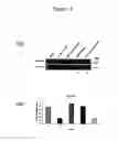 Fig. 13 - Cell-based detection of APF through its interaction with CKAP4 for diagnosis of interstitial cystitis