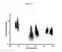 Fig. 28 - Cell-based detection of APF through its interaction with CKAP4 for diagnosis of interstitial cystitis