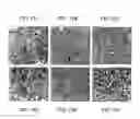 Fig. 14 - CANCER STEM CELLS