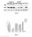 Fig. 12 - SiRNA-mediated gene silencing