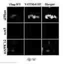 Fig. 22 - SiRNA-mediated gene silencing