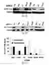 Fig. 27 - SiRNA-mediated gene silencing