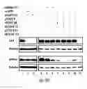 Fig. 35 - SiRNA-mediated gene silencing