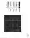 Fig. 06 - Method of making induced pluripotent stem cell from adipose stem cells using minicircle DNA vectors