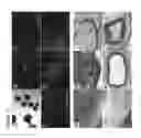 Fig. 14 - Method of making induced pluripotent stem cell from adipose stem cells using minicircle DNA vectors