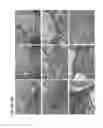 Fig. 22 - Method of making induced pluripotent stem cell from adipose stem cells using minicircle DNA vectors