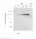 Fig. 07 - Volume exclusion agent to enhance formation of extracellular matrix