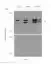 Fig. 09 - Volume exclusion agent to enhance formation of extracellular matrix