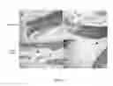Fig. 12 - Volume exclusion agent to enhance formation of extracellular matrix