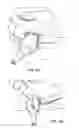 Fig. 09 - Apparatus for Preventing Electrical Shock in Devices
