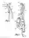 Fig. 02 - Attachment assembly and drive unit having same