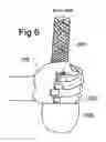 Fig. 07 - Hemisperical grip handle apparatus