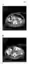Fig. 02 - Methods and Compositions for Treating Viral or Virally-Induced Conditions
