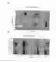 Fig. 04 - Use of ghrelin splice variant for treating hypercholesterolemia and/or high cholesterol and/or high cholesterol complication and/or lipemia and/or lipemia complication and/or coronary heart disease and/or weight management and/or diabetes and/or hyperglycemia