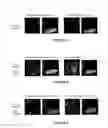 Fig. 04 - Composition For Permeabilizing The Walls Of Microorganisms Comprising The Combination Of Ethylenediaminetetraacetic Acid (EDTA) And Polyethyleneimine (PEI)