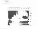 Fig. 09 - Engineered Listeria and methods of use thereof