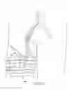 Fig. 22 - Method and system for closed chest blood flow support