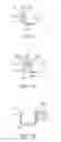 Fig. 09 - Methods and apparatus for transmitting vibrations
