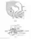 Fig. 02 - Surgical systems and methods for transvaginal apical suspension