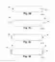Fig. 05 - Devices and methods for tissue restoration
