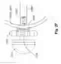 Fig. 33 - Devices and methods for tissue restoration
