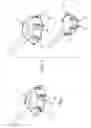 Fig. 02 - Methods of deploying an implantable injection port