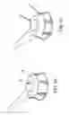 Fig. 12 - Methods of deploying an implantable injection port