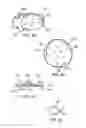 Fig. 32 - Methods of deploying an implantable injection port