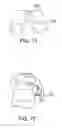 Fig. 37 - Methods of deploying an implantable injection port