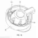 Fig. 40 - Methods of deploying an implantable injection port