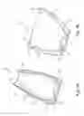 Fig. 05 - Pelvic implant with anchoring frame