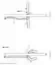 Fig. 10 - CLOSED LOOP GASTRIC RESTRICTION DEVICES AND METHODS