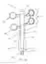Fig. 15 - CLOSED LOOP GASTRIC RESTRICTION DEVICES AND METHODS