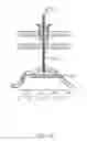 Fig. 19 - CLOSED LOOP GASTRIC RESTRICTION DEVICES AND METHODS