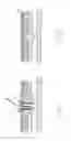 Fig. 22 - CLOSED LOOP GASTRIC RESTRICTION DEVICES AND METHODS