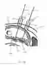 Fig. 24 - CLOSED LOOP GASTRIC RESTRICTION DEVICES AND METHODS