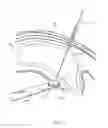 Fig. 28 - CLOSED LOOP GASTRIC RESTRICTION DEVICES AND METHODS