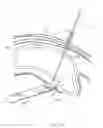Fig. 29 - CLOSED LOOP GASTRIC RESTRICTION DEVICES AND METHODS