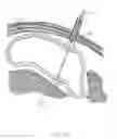 Fig. 31 - CLOSED LOOP GASTRIC RESTRICTION DEVICES AND METHODS