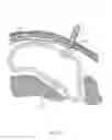 Fig. 32 - CLOSED LOOP GASTRIC RESTRICTION DEVICES AND METHODS