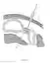Fig. 33 - CLOSED LOOP GASTRIC RESTRICTION DEVICES AND METHODS