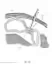 Fig. 35 - CLOSED LOOP GASTRIC RESTRICTION DEVICES AND METHODS