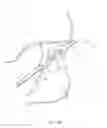 Fig. 37 - CLOSED LOOP GASTRIC RESTRICTION DEVICES AND METHODS