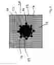 Fig. 05 - Arrangement for implanting and method for implanting