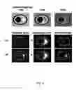 Fig. 08 - Method and System for Plaque Lesion Characterization