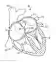 Fig. 01 - Hemodynamic Detection of Circulatory Anomalies