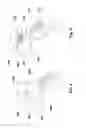 Fig. 04 - Device for bolus administration of contrast agent