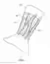 Fig. 02 - BLOOD VESSEL DISPLAY DEVICE