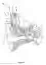 Fig. 02 - Hearing prosthesis with integrated sensors for measuring pressure in a cochlea
